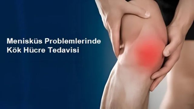 Menisküs Yırtığına Ameliyatsız Çözüm: Kök Hücre Tedavisi