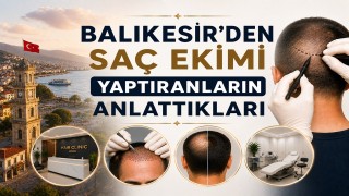 Balıkesir'den Saç Ekimi Yaptıranların Anlattıkları