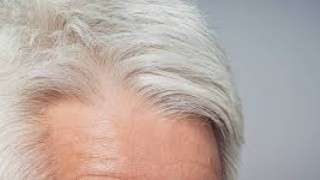 Saçlar Neden Beyazlar: Yaşlanmanın Görünür İzi ve Genetik Sırları