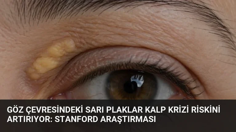 Göz Çevresindeki Sarı Plaklar Kalp Krizi Riskini Artırıyor: Stanford Araştırması