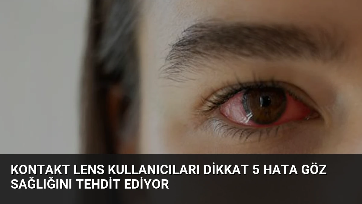 Kontakt Lens Kullanıcıları Dikkat 5 Hata Göz Sağlığını Tehdit Ediyor