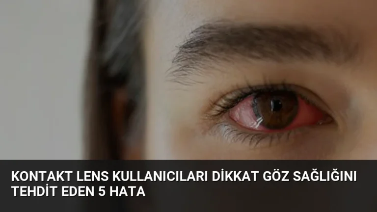 Kontakt Lens Kullanıcıları Dikkat Göz Sağlığını Tehdit Eden 5 Hata