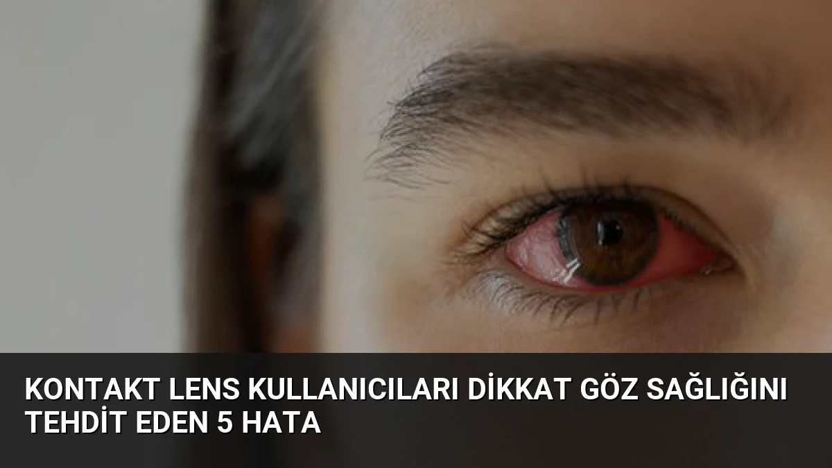 Kontakt Lens Kullanıcıları Dikkat Göz Sağlığını Tehdit Eden 5 Hata