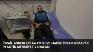 İsrail Askerleri AA Foto Muhabiri İssam Rimavi’yi Plastik Mermiyle Yaraladı