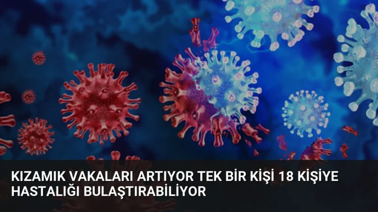 Kızamık Vakaları Artıyor Tek Bir Kişi 18 Kişiye Hastalığı Bulaştırabiliyor