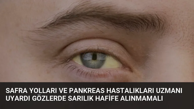 Safra Yolları ve Pankreas Hastalıkları Uzmanı Uyardı Gözlerde Sarılık Hafife Alınmamalı